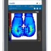 Provides precise measurements and highly-detailed visualisations using AI-powered analysis to optimise patient comfort and safety.
